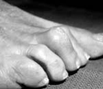 griffes-dorteils-150x130